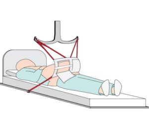 Pannus Apron Sling - Image 4