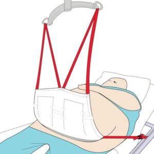 Pannus Apron Sling - Image 3